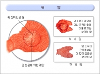 미리보기 이미지